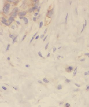 FA2H Rabbit Polyclonal Antibody
