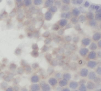 FAAH Rabbit Polyclonal Antibody