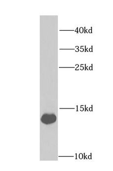 FABP1 Rabbit Polyclonal Antibody