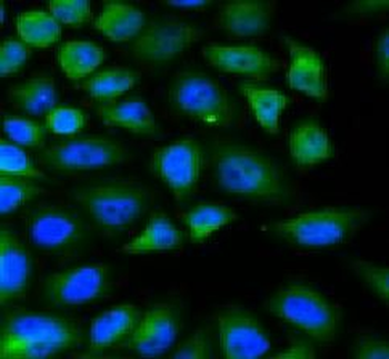 FABP4 Rabbit Polyclonal Antibody