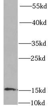 FABP4 Rabbit Polyclonal Antibody