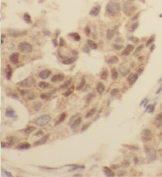 FABP4 Rabbit Polyclonal Antibody