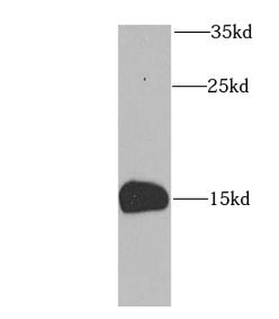 FABP5 Rabbit Polyclonal Antibody