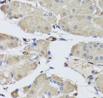 FABP5 Rabbit Polyclonal Antibody