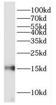 FABP7 Rabbit Polyclonal Antibody