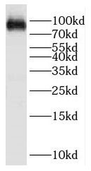 F13A1 Rabbit Polyclonal Antibody