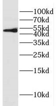 FADS1 Rabbit Polyclonal Antibody