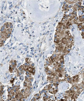 FADS1 Rabbit Polyclonal Antibody