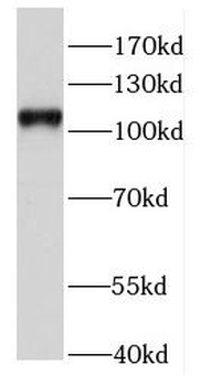 HAUS6 Rabbit Polyclonal Antibody