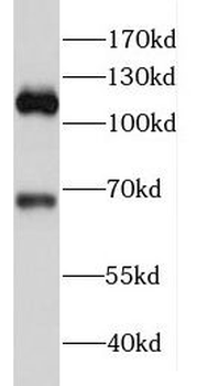 RIPOR2 Rabbit Polyclonal Antibody