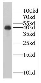 LRATD2 Rabbit Polyclonal Antibody