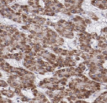 LRATD2 Rabbit Polyclonal Antibody