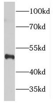 FANCC Rabbit Polyclonal Antibody