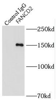 FANCD2 Rabbit Polyclonal Antibody
