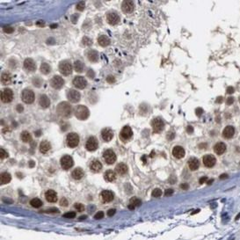 FANCD2 Rabbit Polyclonal Antibody