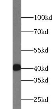 FAS Antibody