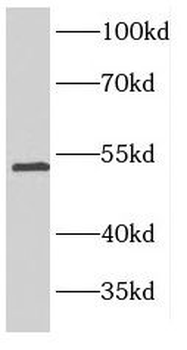 FSCN1 Antibody