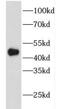 FBLIM1 Rabbit Polyclonal Antibody