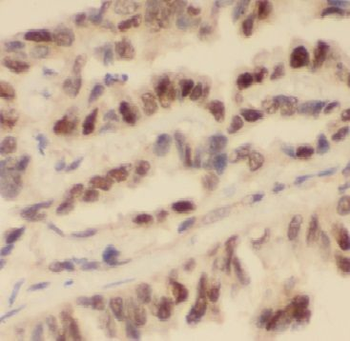 FBLIM1 Rabbit Polyclonal Antibody