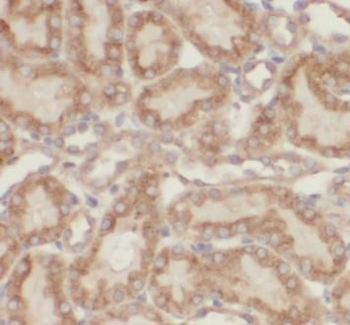 FBP1 Rabbit Polyclonal Antibody