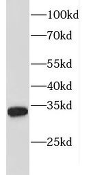 FBXL15 Rabbit Polyclonal Antibody
