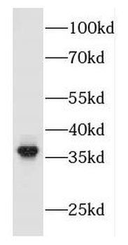 FBXO2 Rabbit Polyclonal Antibody