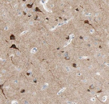 FBXO2 Rabbit Polyclonal Antibody