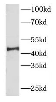 FBXO22 Rabbit Polyclonal Antibody