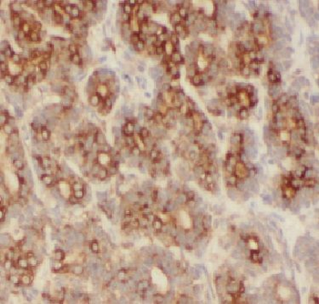 FBXO22 Rabbit Polyclonal Antibody