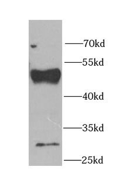 FDFT1 Rabbit Polyclonal Antibody