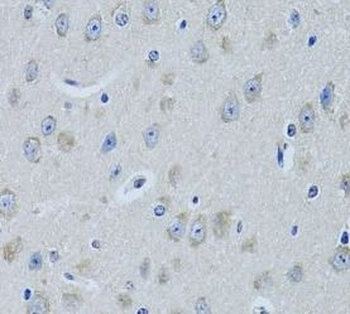 FDFT1 Rabbit Polyclonal Antibody