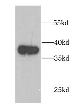 FDPS Rabbit Polyclonal Antibody