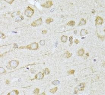 FDPS Rabbit Polyclonal Antibody