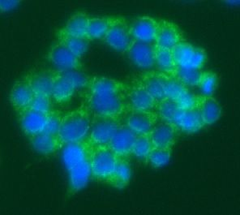 FDX1 Rabbit Polyclonal Antibody