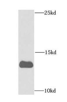 FDX1 Rabbit Polyclonal Antibody