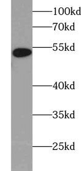 FDXR Rabbit Polyclonal Antibody