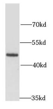 FEN1 Rabbit Polyclonal Antibody