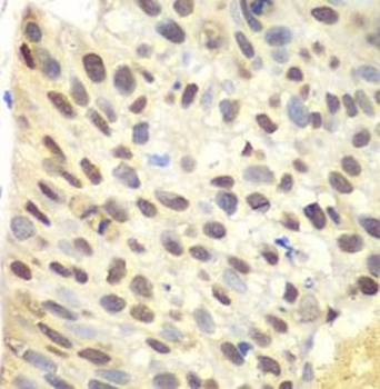 FEN1 Rabbit Polyclonal Antibody