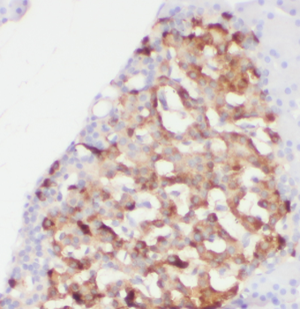 FERMT1 Rabbit Polyclonal Antibody