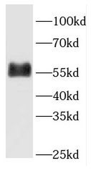FETUB Rabbit Polyclonal Antibody