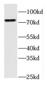 FGD3 Rabbit Polyclonal Antibody