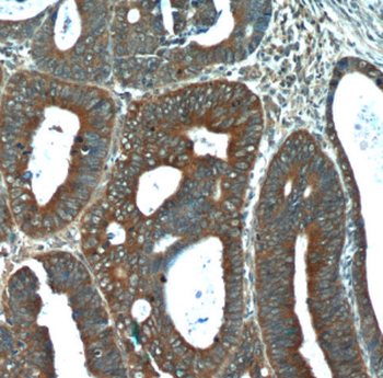 FGFBP1 Rabbit Polyclonal Antibody