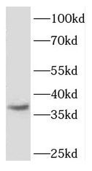 FGFBP2 Rabbit Polyclonal Antibody