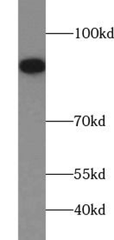 FGFR1 Antibody