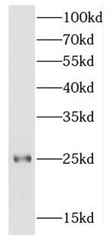 FGFR1OP2 Rabbit Polyclonal Antibody