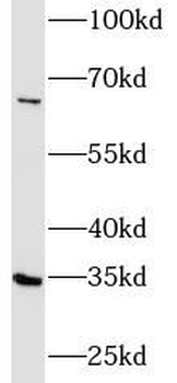 FGL1 Rabbit Polyclonal Antibody
