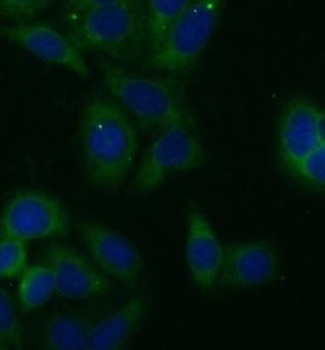 FH Rabbit Polyclonal Antibody