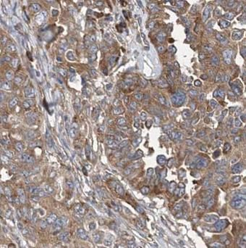 FH Rabbit Polyclonal Antibody