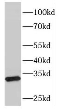 FHL5 Rabbit Polyclonal Antibody