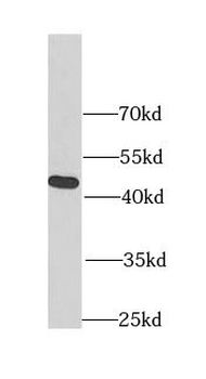 FIBP Antibody